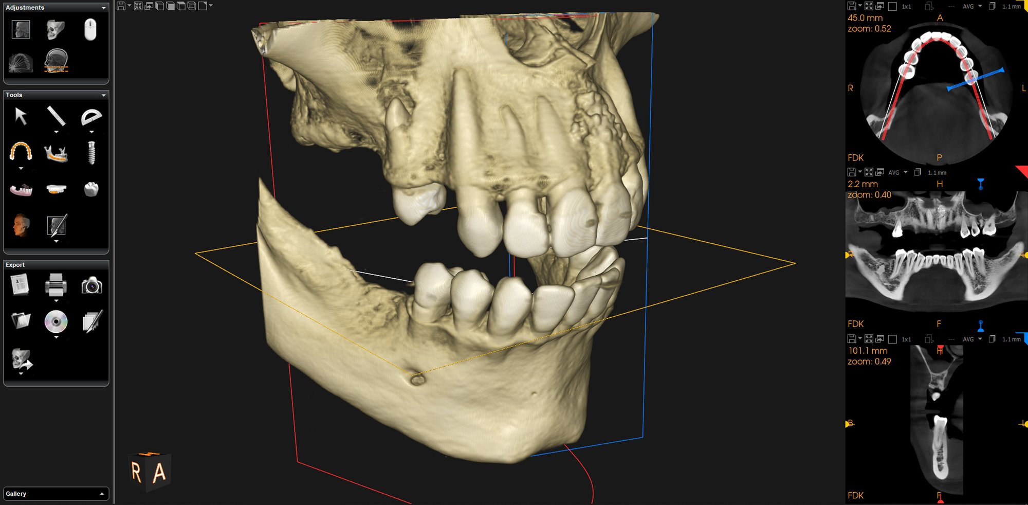 AdobeStock_472671184_CBCT