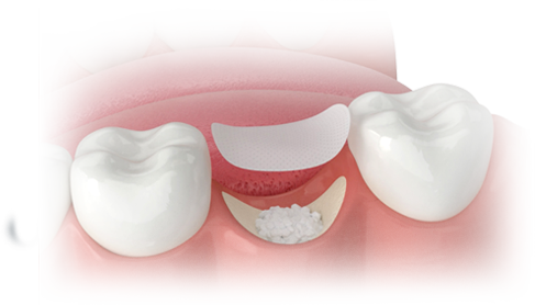 Socket Grafting Image Faded Landing Page