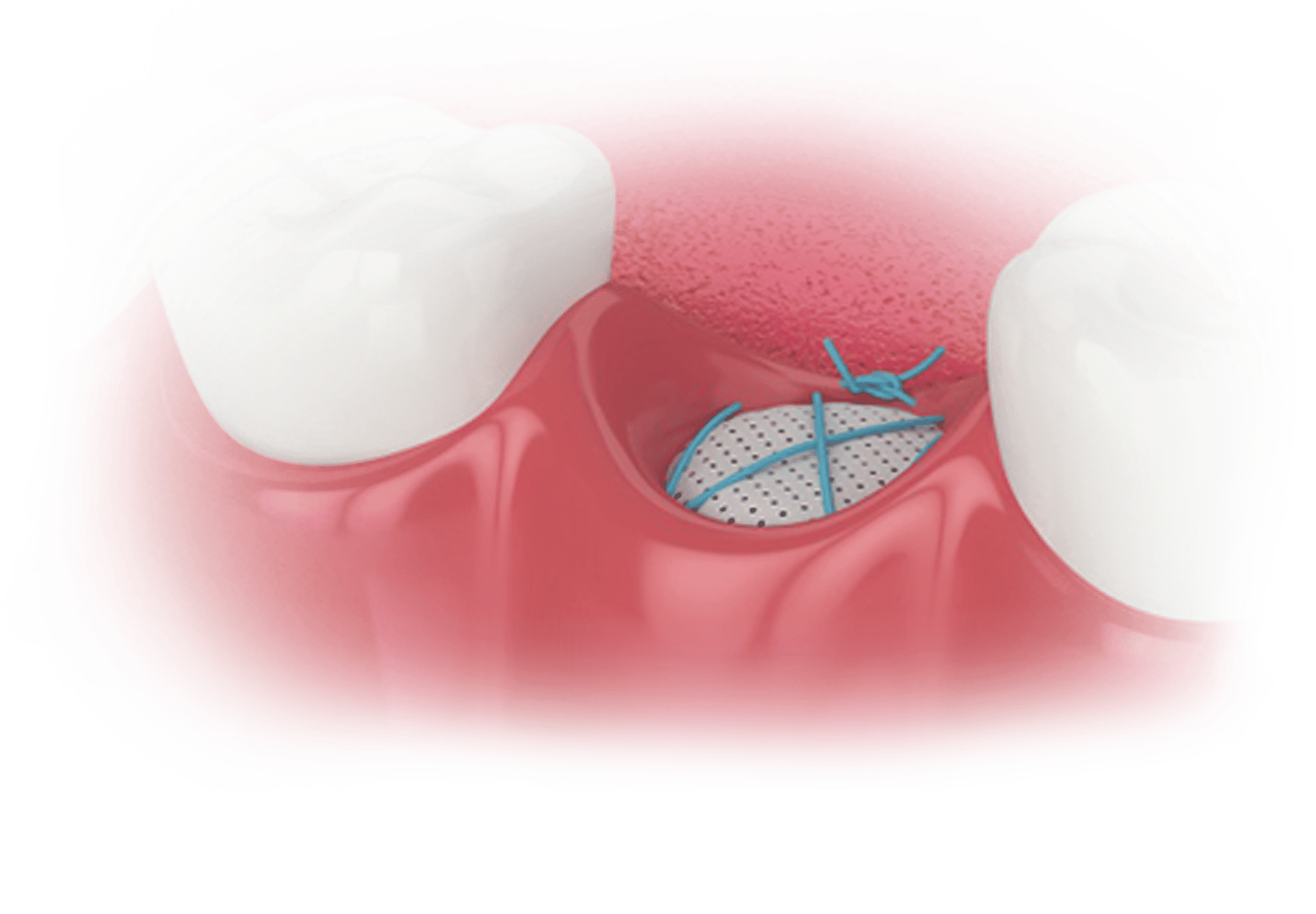 Suturing Landing Page Image-2